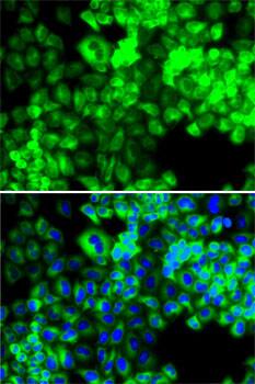 Seryl tRNA synthetase Antibody