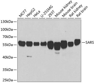 Seryl tRNA synthetase Antibody