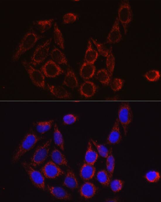 SECISBP2 Antibody