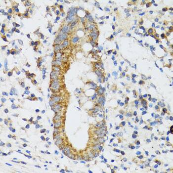 SRP19 Antibody