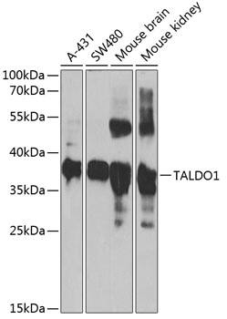 Transaldolase 1 Antibody