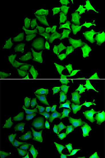 Transaldolase 1 Antibody