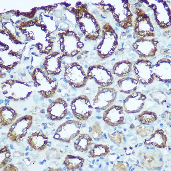 UQCRFS1 Antibody