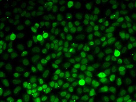 Exportin-5 Antibody