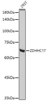 ZDHHC17 Antibody