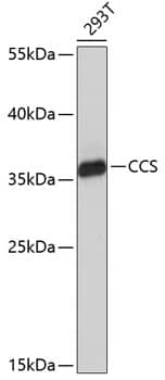 CCS/SOD4 Antibody