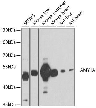 Salivary Amylase Alpha Antibody