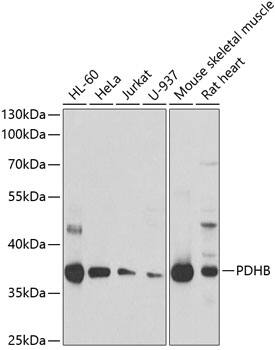 Pyruvate Dehydrogenase E1 beta subunit Antibody