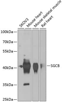 beta Sarcoglycan Antibody