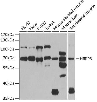 HIRIP3 Antibody