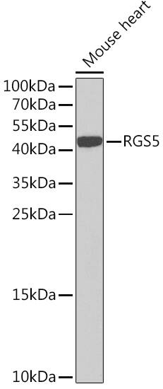 RGS5 Antibody