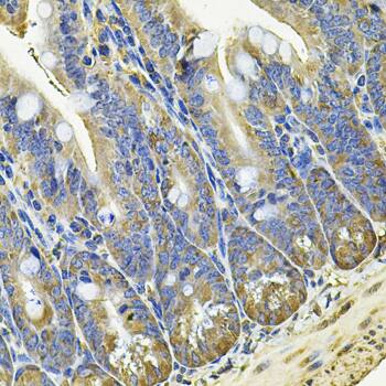 EIF3C Antibody