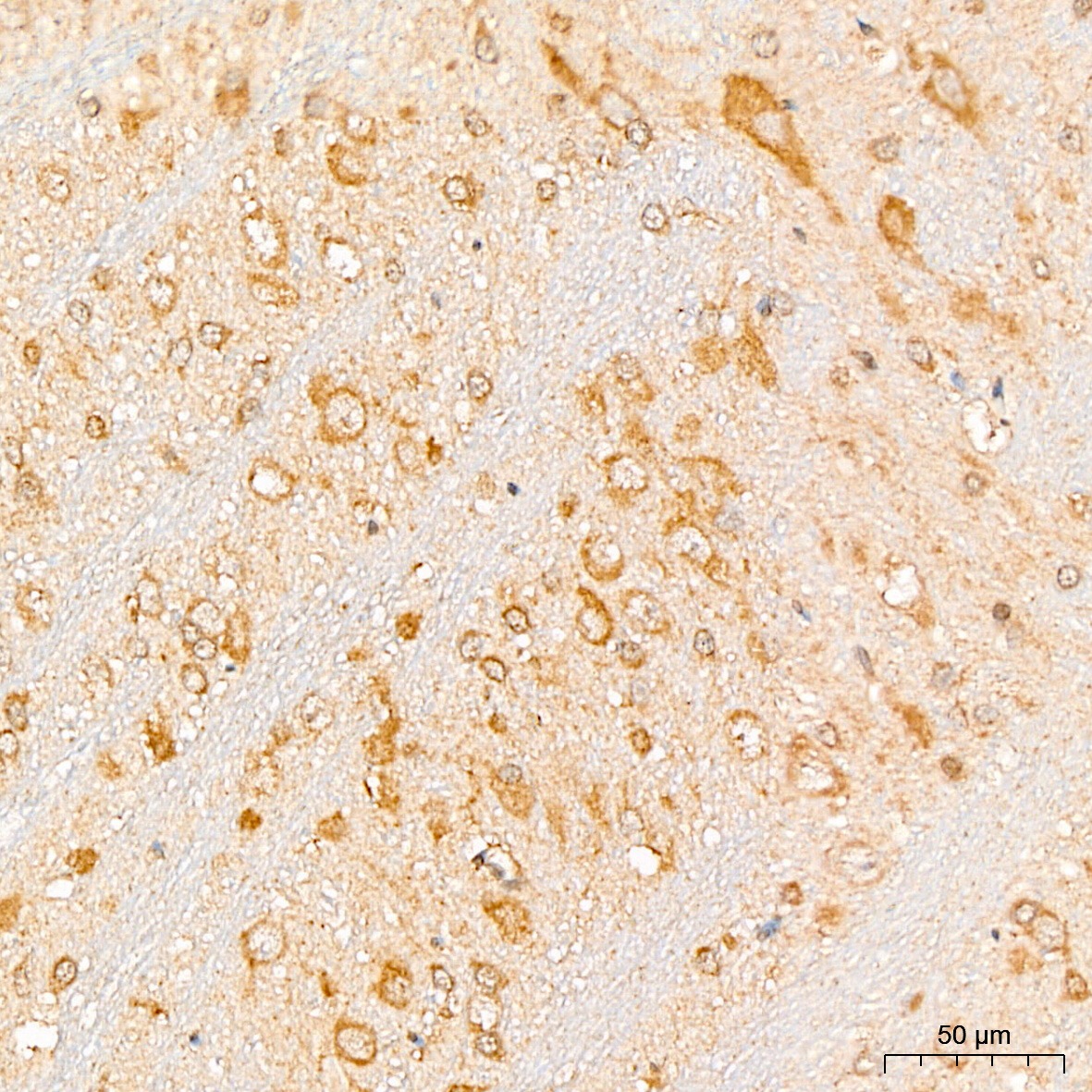 EIF3F Antibody