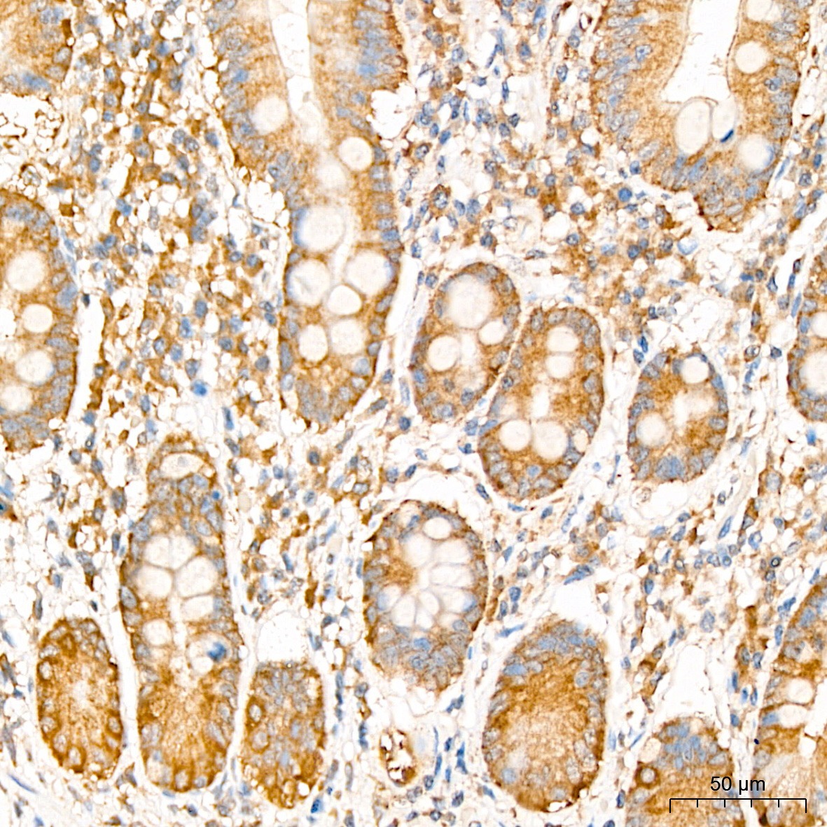 EIF3F Antibody
