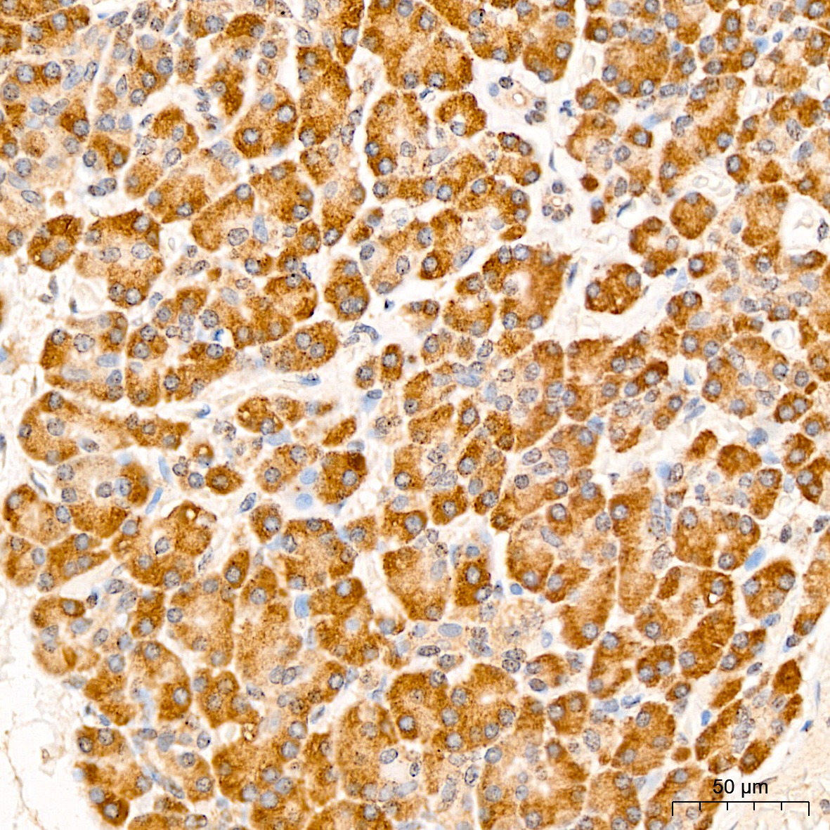 EIF3F Antibody