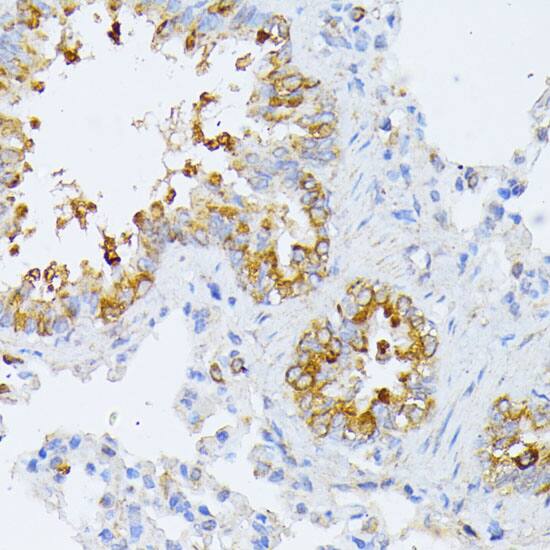 EIF2B2 Antibody