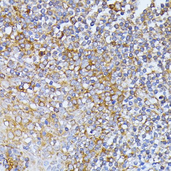 EIF2B2 Antibody
