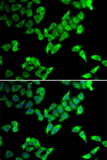 Cip4 Antibody