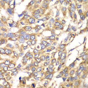 VTI1B Antibody
