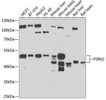 P2X2/P2RX2 Antibody