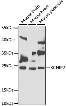 KChIP2 Antibody