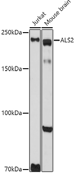 Als2 Antibody
