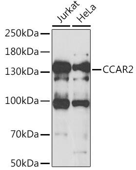DBC1/p30 Antibody