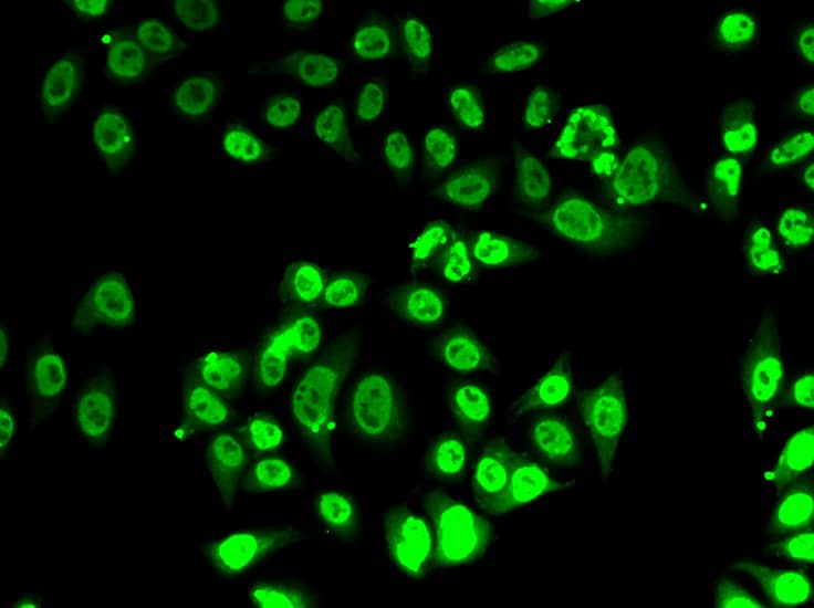 FIP1L1 Antibody