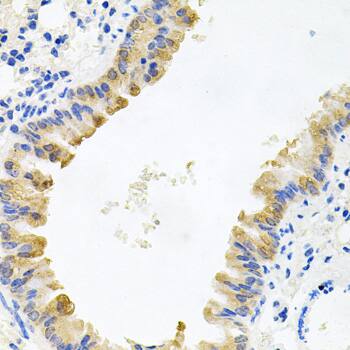 ALKBH8 Antibody