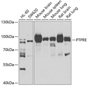 PTP epsilon Antibody