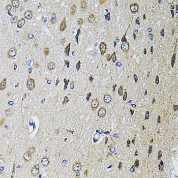 PTP epsilon Antibody