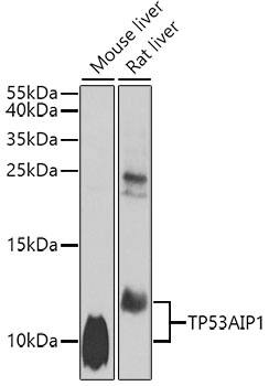 p53 AIP1 Antibody