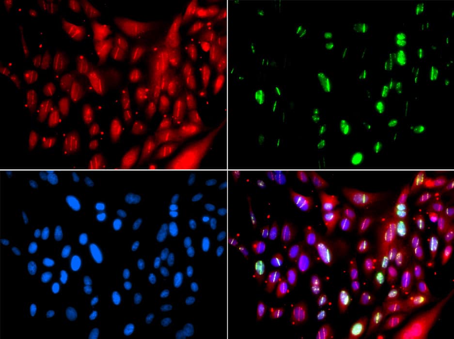 RAP80 Antibody