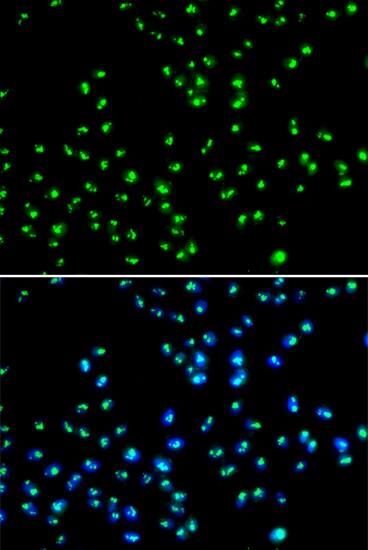 NAT10 Antibody