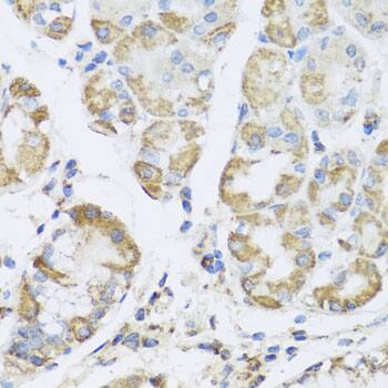 AMPK gamma 1 Antibody