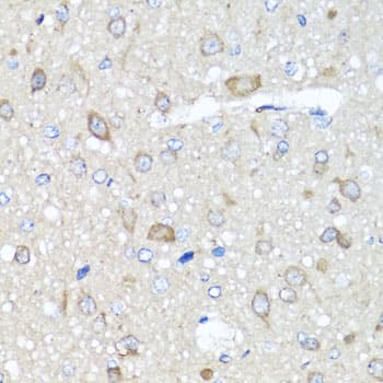 AMPK gamma 1 Antibody