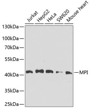 Mannose Phosphate Isomerase Antibody