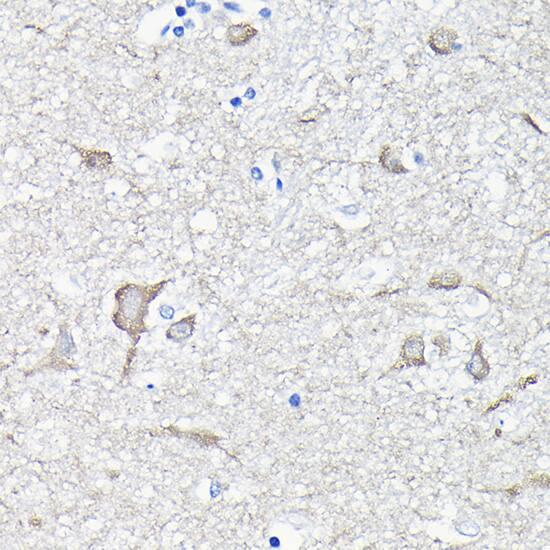 EEF1A2 Antibody