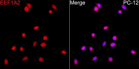 EEF1A2 Antibody