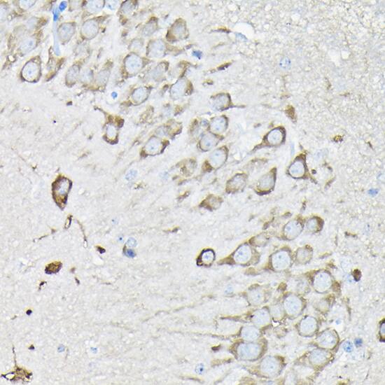 EEF1A2 Antibody
