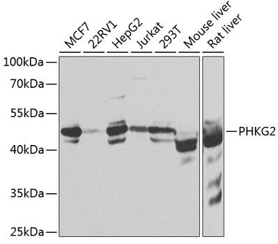 PHKG2 Antibody