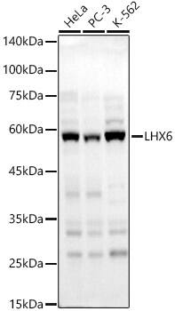 LHX6 Antibody