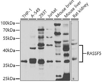 NORE1 Antibody