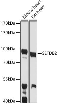 SETDB2 Antibody