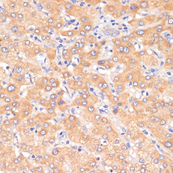 PDCD2L Antibody