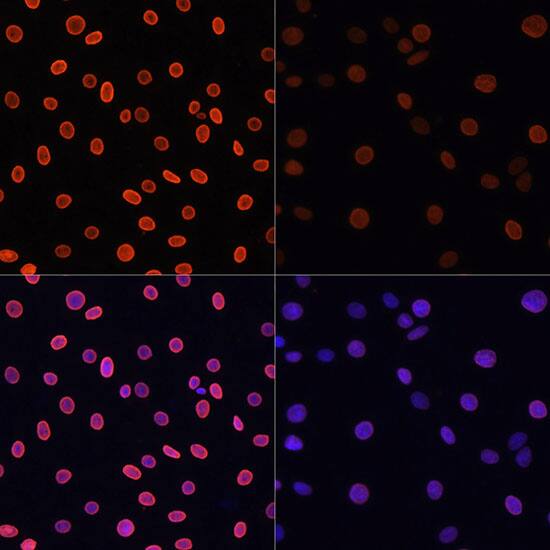 H4 Clustered Histone 1 [ac Lys91] Antibody