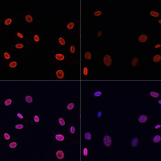 H4 Clustered Histone 1 [ac Lys91] Antibody