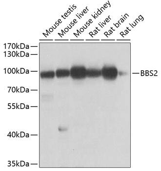 BBS2 Antibody