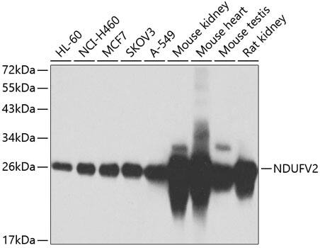 NDUFV2 Antibody