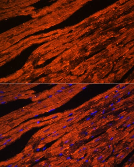 LDB3 Antibody